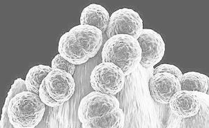 最新研究：細(xì)菌耐藥性或給基因療法設(shè)置障礙