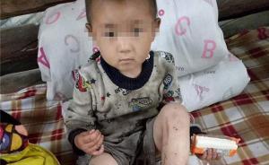 3歲女童走失獨自在蒼山待一夜，次日被奶奶在崖邊小洞找到
