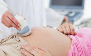 退休醫(yī)生勾結(jié)B超醫(yī)生非法進(jìn)行胎兒性別鑒定，受黨紀(jì)政紀(jì)處分