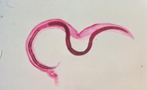 為獲取疫苗探路，17名志愿者讓血吸蟲(chóng)鉆入體內(nèi)