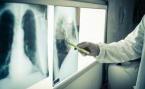 中國(guó)慢阻肺患者近1億人，吸煙者患病風(fēng)險(xiǎn)顯著高于不吸煙者