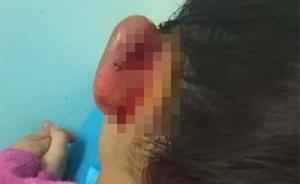 神木教育局回應(yīng)幼兒園女童耳部受傷：涉事教師停職，警方調(diào)查