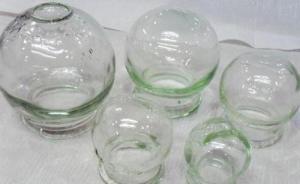 河南一高校附屬醫(yī)院醫(yī)生被舉報拔罐時猥褻女大學生：要求拔胸