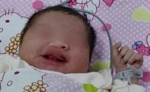 海南唇腭裂女嬰被棄海防林：出生5天左右，民政部門送醫(yī)救治