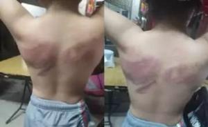 廈門民辦小學(xué)女教師戒尺體罰女生，學(xué)校：已和解，教師被辭退