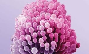 黃曲霉毒素超標(biāo)再引關(guān)注：毒素污染重災(zāi)區(qū)與癌癥高發(fā)密切相關(guān)