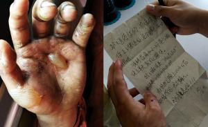 老奶奶給撲火燙傷戰(zhàn)士寄藥：我好著急