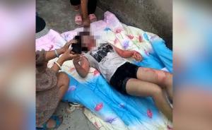 少女被开水灌喉，嫌犯疑为母亲“情敌”