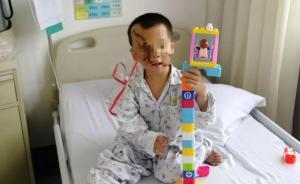 大狗撕咬4歲男童臉，狗主人稱出院再賠