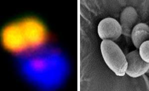 中国人工合成生命里程碑：创建全球首例人造单染色体真核细胞