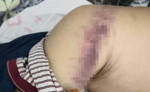陜西城固病休民警毆打六旬女鄰居致其病危，涉事民警被刑拘