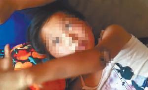 哈爾濱十歲女孩被脫落網(wǎng)線電倒，兩玩伴冒險(xiǎn)挪線救人