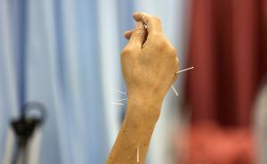 針灸推拿中藥等替代療法能治癌癥？權(quán)威期刊：會(huì)增加死亡風(fēng)險(xiǎn)